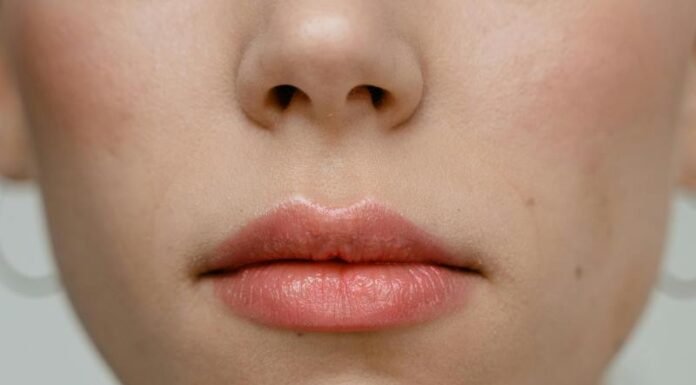 A beauty expert’s guide to common skin marks beauty face skin